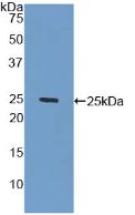 Polyclonal Antibody to Galactosidase Beta (GLb)