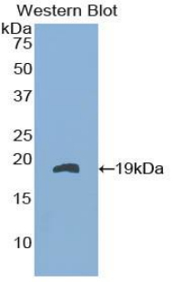 Polyclonal Antibody to Fatty Acid Binding Protein 9, Testis (FABP9)