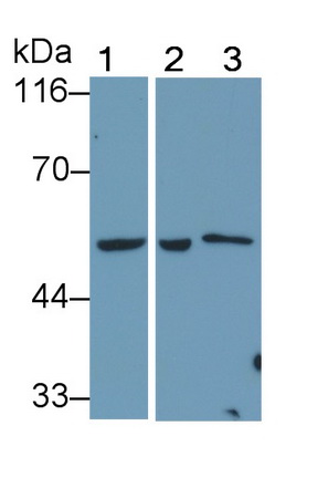 Polyclonal Antibody to Alanine Aminotransferase (ALT)