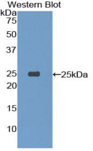 Polyclonal Antibody to Triggering Receptor Expressed On Myeloid Cells 1 (TREM1)