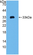 Polyclonal Antibody to Collagen Type I Alpha 2 (COL1a2)