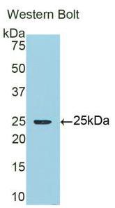 Polyclonal Antibody to Alpha-1-Microglobulin (a1M)