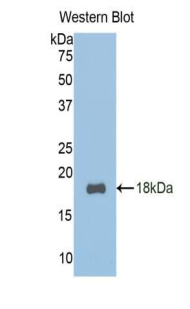 Polyclonal Antibody to Transcription factor 20 (TCF20)