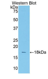Polyclonal Antibody to Transcription factor 20 (TCF20)