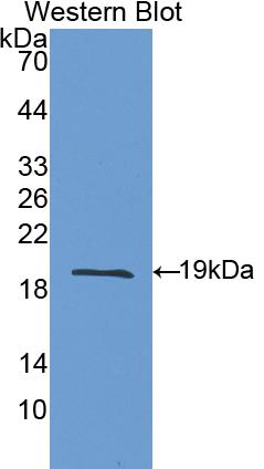 Polyclonal Antibody to Interleukin 1 Receptor Antagonist (IL1RA)