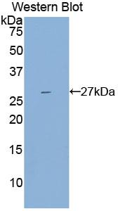 Polyclonal Antibody to Interleukin 2 Receptor Beta (IL2Rb)