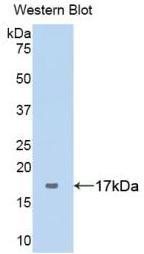 Biotin-Linked Polyclonal Antibody to Complement 1 Inhibitor (C1INH)