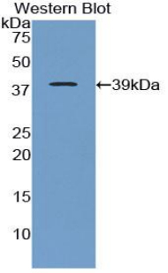 Polyclonal Antibody to Apolipoprotein C1 (APOC1)