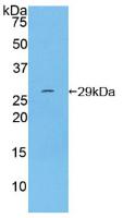 Polyclonal Antibody to Integrin Alpha D (ITGaD)