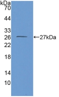 Polyclonal Antibody to Glutamate Dehydrogenase 1 (GLUD1)