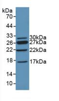 Polyclonal Antibody to Chromodomain Helicase DNA Binding Protein 3 (CHD3)