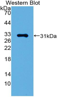 Polyclonal Antibody to GATA Binding Protein 1 (GATA1)
