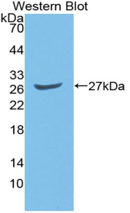Polyclonal Antibody to GATA Binding Protein 2 (GATA2)