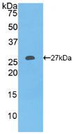 Polyclonal Antibody to Collagen Type I Alpha 1 (COL1a1)