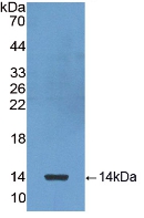 Polyclonal Antibody to Chemokine (C-X-C motif) ligand 7 ( CXCL7)