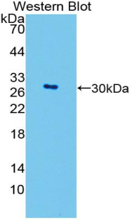 Polyclonal Antibody to GATA Binding Protein 4 (GATA4)