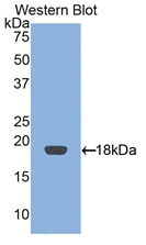 Polyclonal Antibody to Retinol Binding Protein 2, Cellular (RBP2)