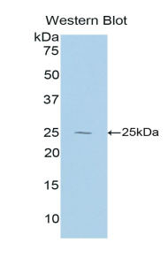 Polyclonal Antibody to Interleukin 27A (IL27A)