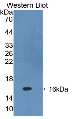 Polyclonal Antibody to Protein Kinase Inhibitor Gamma (PKIg)