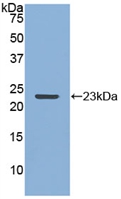 Polyclonal Antibody to Matrix Metalloproteinase 12 (MMP12)