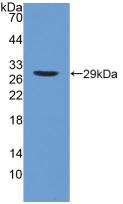 Polyclonal Antibody to Phospholipase A2, Calcium Independent (iPLA2)