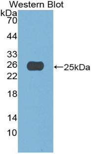 Polyclonal Antibody to Apobec 1 Complementation Factor (ACF)