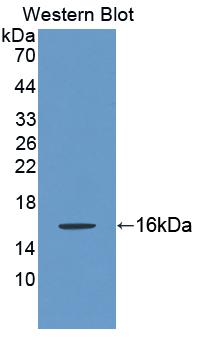 Polyclonal Antibody to Keratin 2 (CK2)