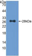 Polyclonal Antibody to Cyclin Dependent Kinase 9 (CDK9)