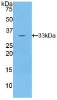 Polyclonal Antibody to Protein Kinase N1 (PKN1)