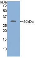 Polyclonal Antibody to Ataxin 1 (ATXN1)
