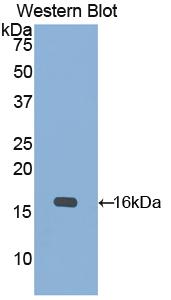Polyclonal Antibody to Cytokeratin 15 (CK15)