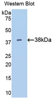 Polyclonal Antibody to Cytokeratin 15 (CK15)