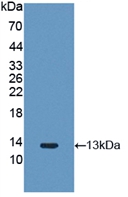 Polyclonal Antibody to Fibroblast Growth Factor 2, Basic (FGF2)