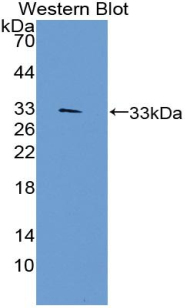 Polyclonal Antibody to Telomerase protein component 1 (TEP1)