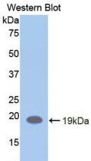 Polyclonal Antibody to Leukemia Inhibitory Factor Receptor (LIFR)