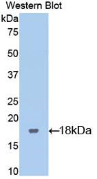 Polyclonal Antibody to Leukemia Inhibitory Factor Receptor (LIFR)