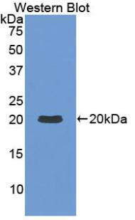 Polyclonal Antibody to Interleukin 1 Beta (IL1b)