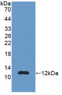 Polyclonal Antibody to S100 Calcium Binding Protein A11 (S100A11)