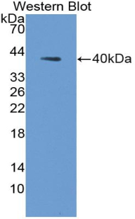 Polyclonal Antibody to Aquaporin 2, Collecting Duct (AQP2)