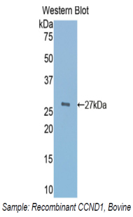 Polyclonal Antibody to Cyclin D1 (CCND1)
