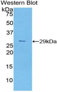 Polyclonal Antibody to Cyclin D2 (CCND2)