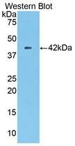 Polyclonal Antibody to Carboxypeptidase B2 (CPB2)