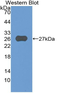 Polyclonal Antibody to A Disintegrin And Metalloprotease 8 (ADAM8)