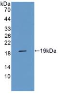 Polyclonal Antibody to Receptor For Advanced Glycation Endproducts (RAGE)