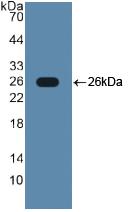 Polyclonal Antibody to Toll Like Receptor 2 (TLR2)