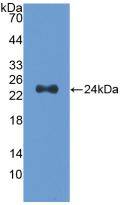 Polyclonal Antibody to Slit Homolog 2 (Slit2)