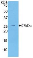 Polyclonal Antibody to Coagulation Factor XII (F12)