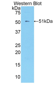 Polyclonal Antibody to Kallikrein 8 (KLK8)