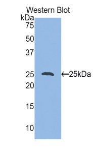 Polyclonal Antibody to Heat Shock Protein 27 (Hsp27)