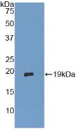 Polyclonal Antibody to Delta-Sleep Inducing Peptide (dSIP)